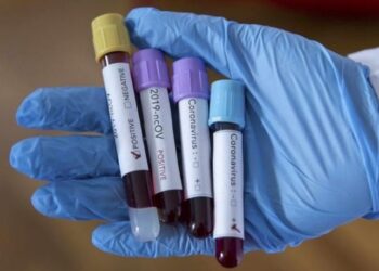 Alarmon Zvicra: 8737 raste me koronavirus në 72 orët e fundit